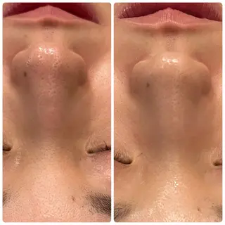 yellow.所属・yellow💛【 脱毛&フェイシャル】のエステ・リラクイメージ