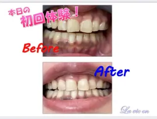 セルフホワイトニングサロン　ラヴィアン所属・ホワイトニングサロン La vie enのその他イメージ