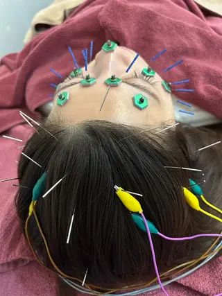 美容鍼灸女性専用 りんご鍼灸治療院のその他イメージ