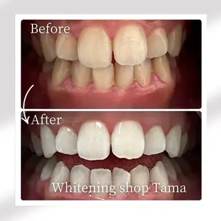 メンズ ホワイトニング ショップ多摩店のその他イメージ