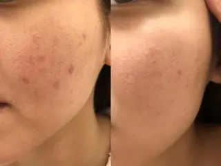 本格エステの ヘッドスパのその他イメージ