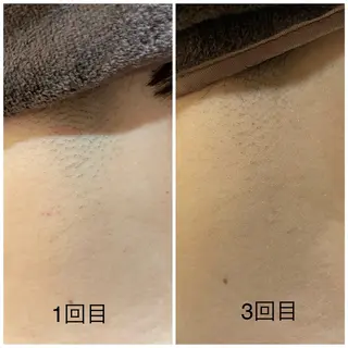 leolo武蔵浦和 肌質改善＆脱毛のエステ・リラクイメージ