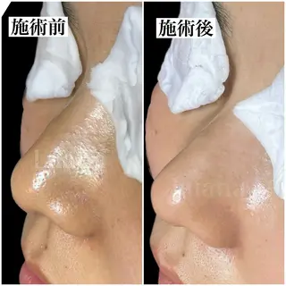 マツヤニWax専門/ 岸和田/Luanaのエステ・リラクイメージ