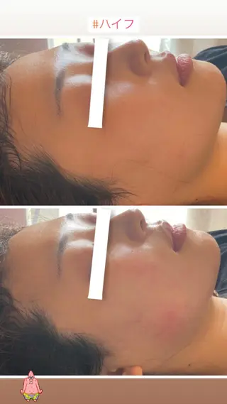 FLEUR大阪・整体 ・ハイフ・痩身・小顔のエステ・リラクイメージ