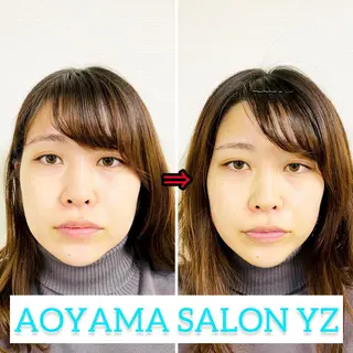 小顔美容鍼専門サロン 渋谷YZのエステ・リラクイメージ