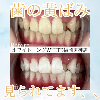 メンズ ホワイトニング専門店 WHITE天神店のエステ・リラクイメージ