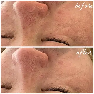 メンズ メナード岐阜茜部 杉浦のエステ・リラクイメージ