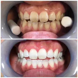 セルフホワイトニングサロンMW 稲毛店所属・セルフホワイトニング サロンMW稲毛店のその他イメージ