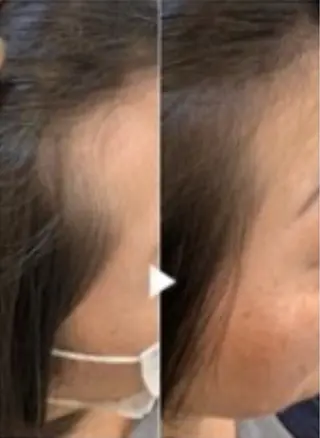 40代からの髪悩み 専門美髪アドバイザーのヘアスタイル