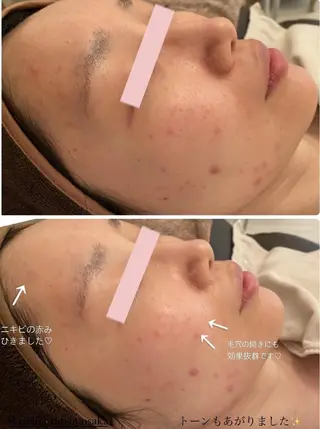 ✨美肌水光✨ アトリエリュバンのエステ・リラクイメージ