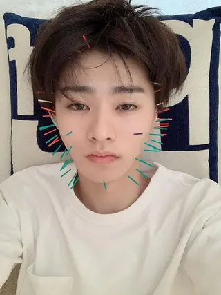 鍼灸整骨院Refine所属・鍼灸 Refineのその他イメージ