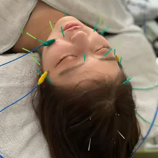 新宿hari-me所属・美容鍼hari-me 新宿のエステ・リラクイメージ