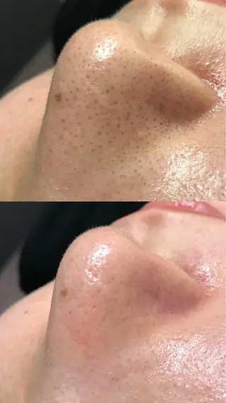 Lilyboo 池袋のエステ・リラクイメージ