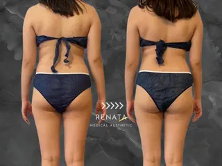 RENATA🕊 脂肪冷却専門店六本木のエステ・リラクイメージ