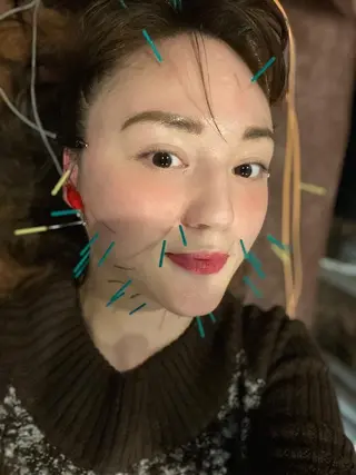 メンズ 美容鍼灸サロン LOMIHARIのエステ・リラクイメージ