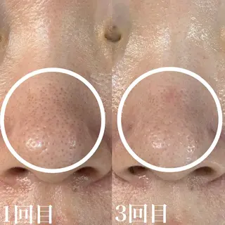 WHITE AQUA 北千住店のエステ・リラクイメージ