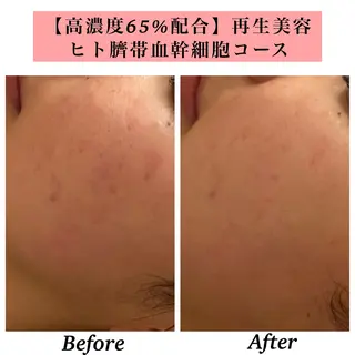 Bellesthe (ベルエステ)のエステ・リラクイメージ