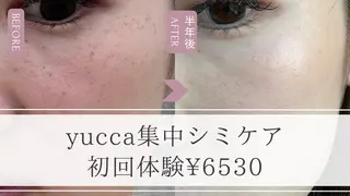 シミ毛穴専門店 yucca(ユッカ)のエステ・リラクイメージ
