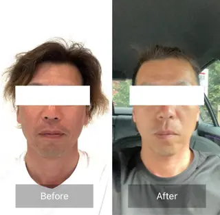 小顔と ヘッドスパのお店のエステ・リラクイメージ