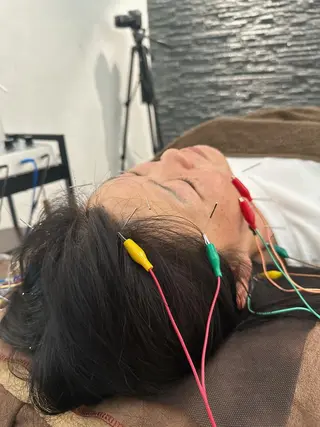 美容鍼灸整体サロンBeauJu所属・小顔矯/美容鍼/鍼灸 BeauJuのその他イメージ