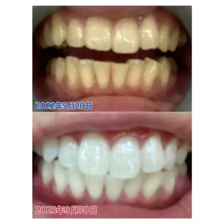 MBEAUTYSALON 千葉店・京成大久保所属・Melty 輝のその他イメージ