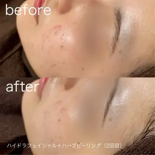 lulularico Yu🫧のエステ・リラクイメージ