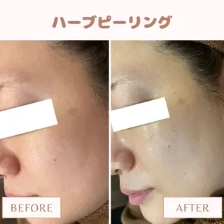 メンズ キッズ Amaryllis 🌹松本のエステ・リラクイメージ