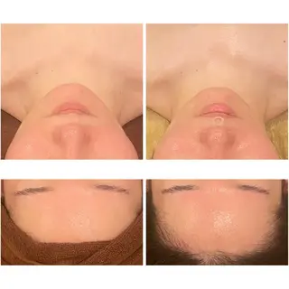 通うほど変わる本格 エステ心斎橋REVIのエステ・リラクイメージ