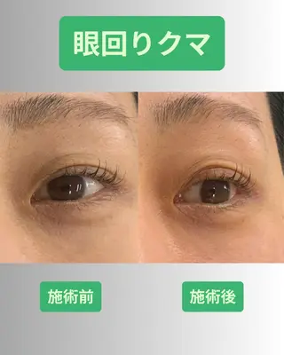 河輪 鍼灸接骨院のエステ・リラクイメージ