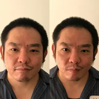 そとやまのはり おきゅう所属・外山 勝敏のエステ・リラクイメージ