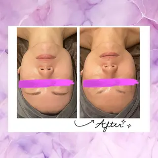 ☆痩身/小顔☆ 結果出します☆のエステ・リラクイメージ