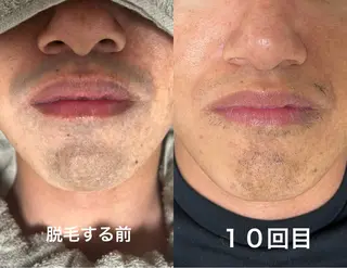 メンズ Akala miのエステ・リラクイメージ