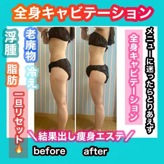 痩身/脱毛/ネイル HARUKAのエステ・リラクイメージ