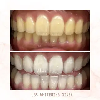 メンズ LBSホワイトニング 銀座店💎店長浦和のその他イメージ