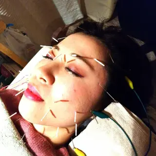 むくみたるみ専門☆ 美容鍼・小顔矯正のエステ・リラクイメージ