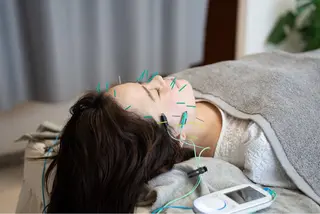 鍼灸•マッサージサロンCalfa所属・《美肌･小顔》美容鍼 ＆マッサージ＊MEIのエステ・リラクイメージ