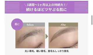 マツエク・マツパ 眉毛/まつ毛/美肌 moonのマツエク・マツパデザイン