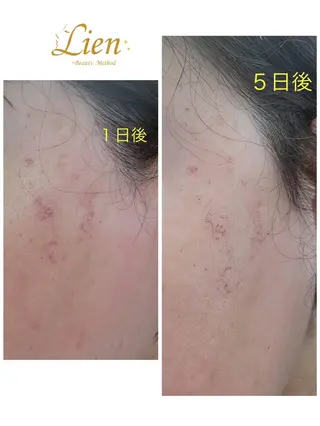 Lien オーナー 山口智嘉のエステ・リラクイメージ