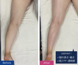 美容鍼/ヘッドスパ/ 💎さかもとのエステ・リラクイメージ