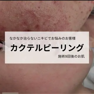 桐山 まどかのエステ・リラクイメージ