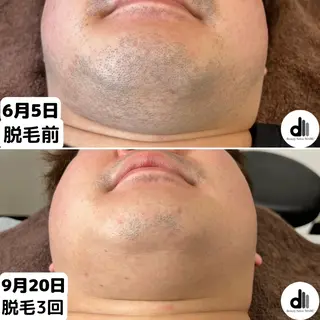メンズ Beauty Salon MARU所属・新潟市メンズ【脱毛】 MARUのエステ・リラクイメージ