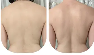 整体エステ　NEW ME所属・深層リンパオイル/小 顔とドライヘッドスパのエステ・リラクイメージ