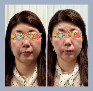 麻布十番/圧倒的小顔 毒出し美容🎀鍼灸のエステ・リラクイメージ