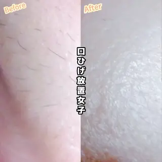 Hit. シュガーリング豊橋のエステ・リラクイメージ