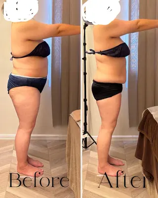 les SALON所属・les SALON/ 痩身/首肩こり/脱毛のエステ・リラクイメージ