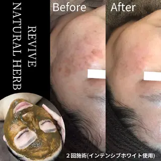 ユニセックスエステサロンUniclear所属・男女エステユニクリア Uniclearのエステ・リラクイメージ