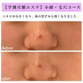 Bellesthe (ベルエステ)のエステ・リラクイメージ