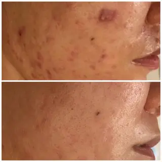 触れたくなる モテ肌へ...❤︎のエステ・リラクイメージ