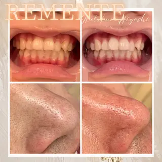 REMENTE🌷 Maoの眉毛・アイブロウイメージ