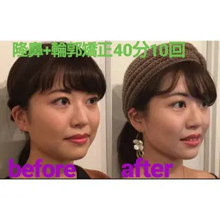 隆鼻矯正専門店ラプリ 佐藤のエステ・リラクイメージ